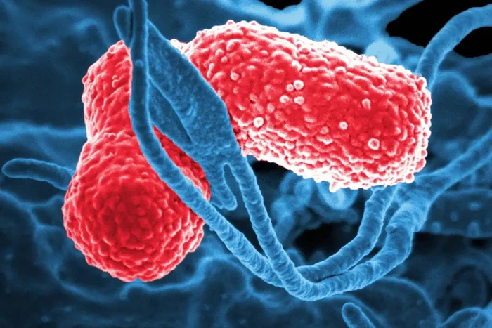 17 Menores muertos por la bacteria Klebsiella oxytoca