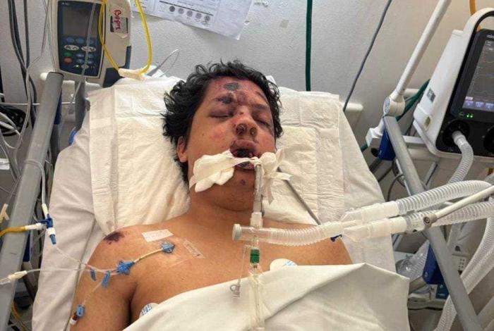 Ayúdanos a identificar a joven accidentado en Morelia el sábado