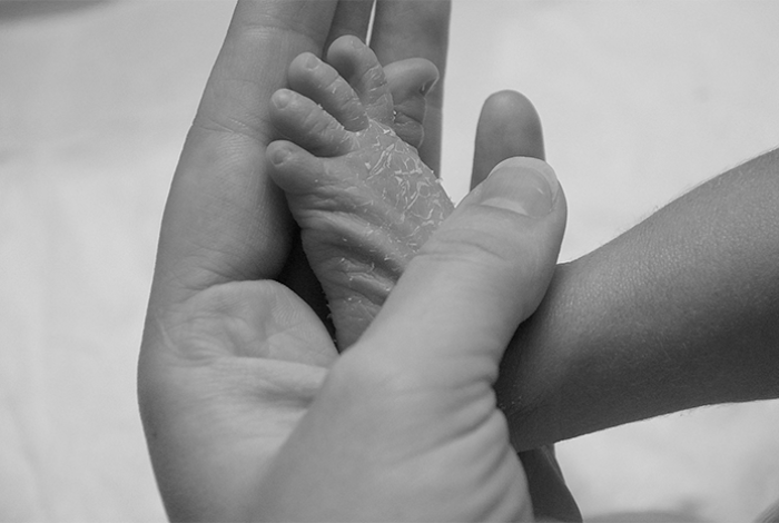 Casi 5 millones de niños menores de 5 años mueren al año en el mundo, un 58 %, en África