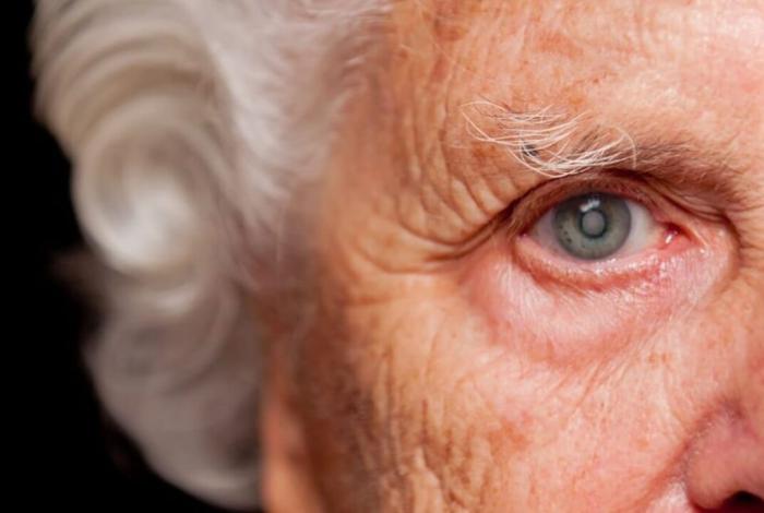 Cataratas, la oscuridad que ciega