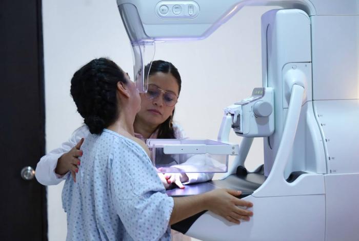 Con 28 mil estudios de mama, la SSM intensifica lucha contra el cáncer