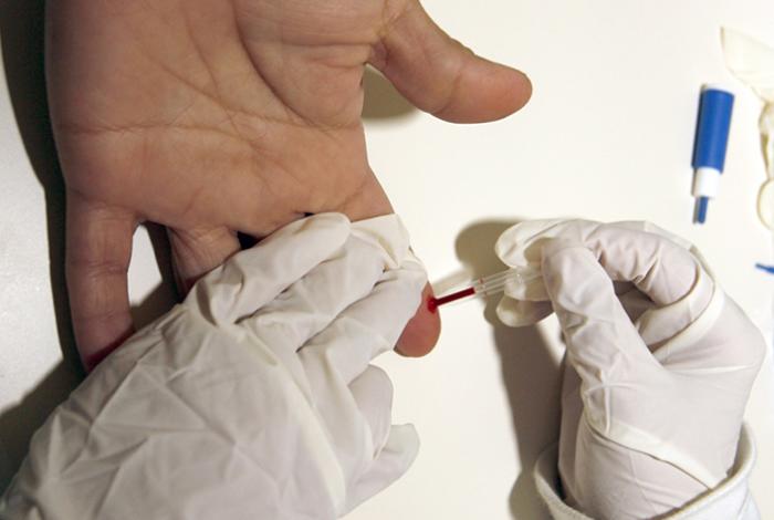 Desarrollan una inmunoterapia para revertir el daño cardiaco debido al colesterol