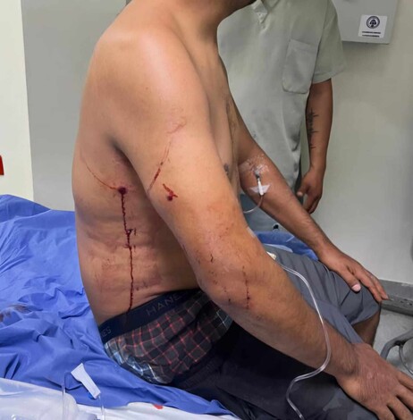 Detienen a hombre de 79 años por tentativa de homicidio en Apatzingán