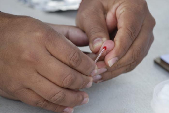 Inmunoterapia experimental o trasplantes de células madre, distintas vías contra el VIH
