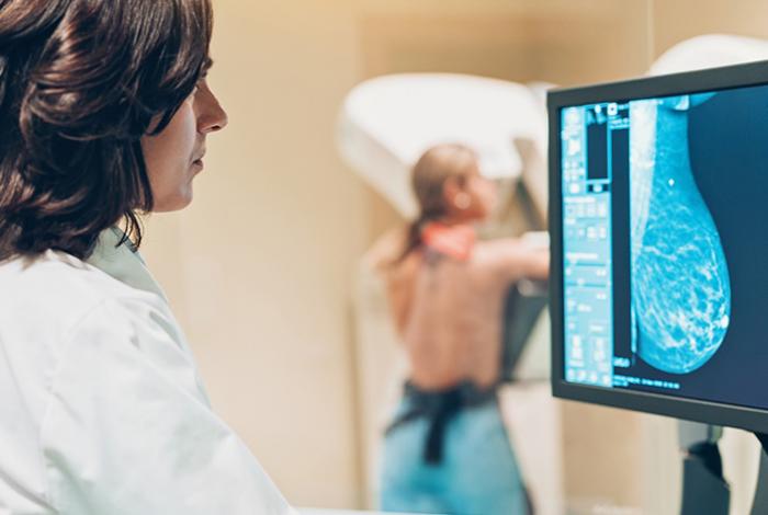 Inteligencia Artificial podría revolucionar detección temprana del cáncer de mama