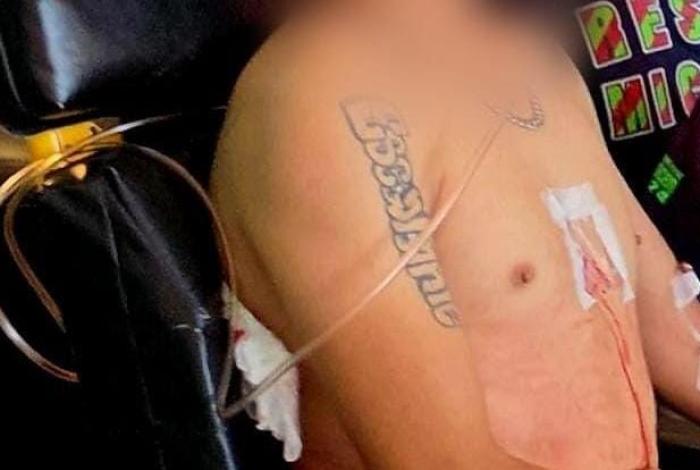 Jacona: ataque armado deja a un hombre herido