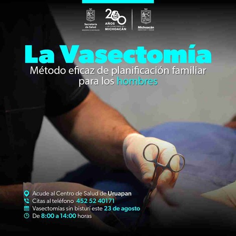 Jornada de Vasectomía sin Bisturí gratuita, el 23 de agosto en el Centro de Salud de Uruapan