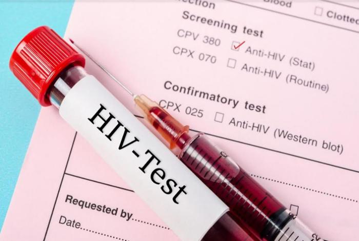 Lenacapavir, el tratamiento preventivo contra el VIH que cuesta 28 mil dólares, pero no llega a México