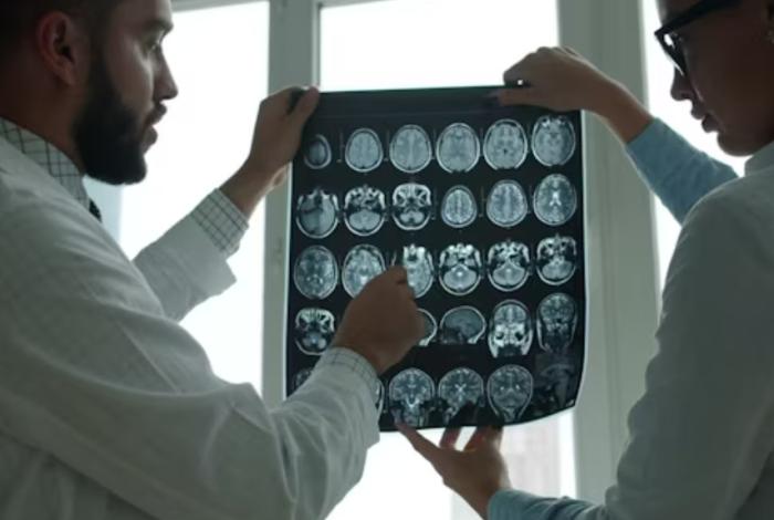 Más conciencia, menos estigmas: Día Internacional de la Epilepsia