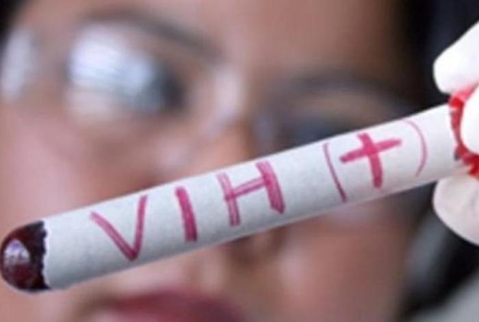 Michoacán: 165 nuevos casos de VIH/SIDA este año