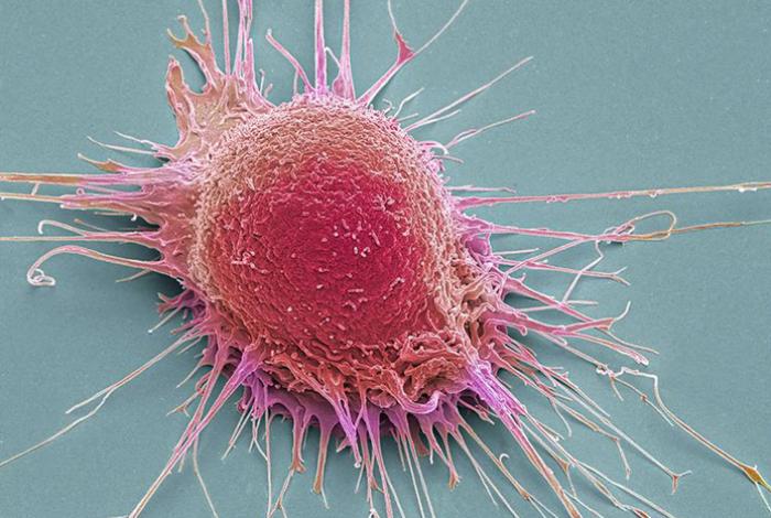 Minibiosensores para detectar el cáncer en minutos y a partir de una sola gota de muestra