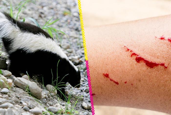 Muere joven infestada de rabia por un zorrillo en Zacatecas