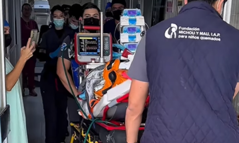 Niño de 7 sufre quemaduras graves por reto