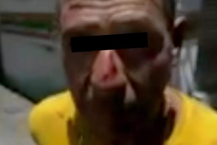 Presunto ladrón es sorprendido por vecinos, golpeado y le amputaron un dedo, en Uruapan