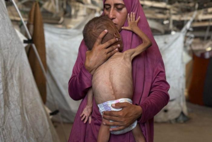 "Quisiera estar en el cielo": los niños de Gaza ya no tienen fuerza para llorar