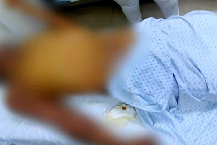 Salvaje golpiza a José Joaquín en Apatzingán