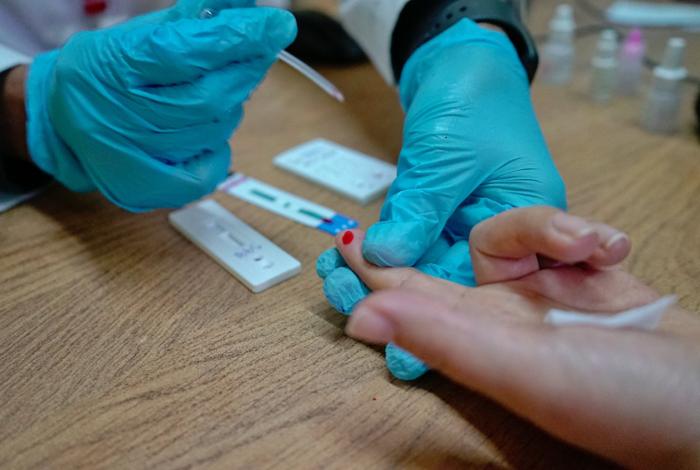 SSM realiza sin costo prueba rápida para detectar la hepatitis C