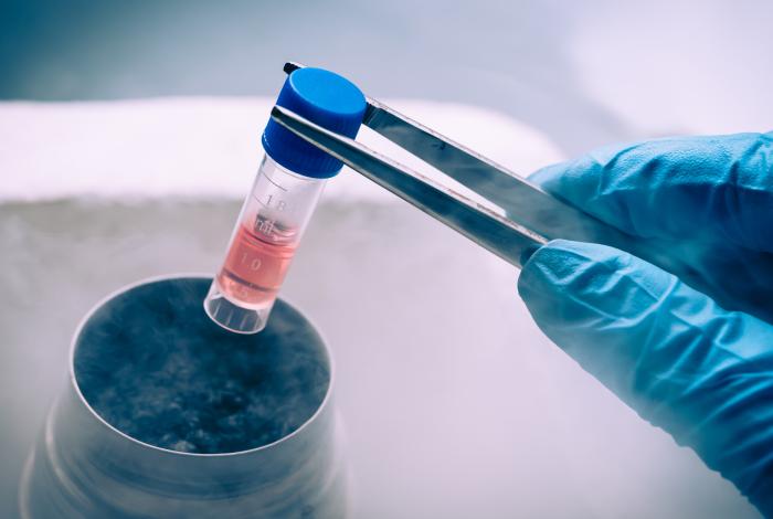 Todo lo que debes de saber sobre la donación de células madre